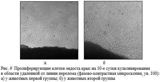 Схема остеогенного диференціювання стовбурових клітин