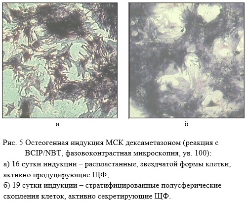Light microscopy displaying rounded polygonal MSCs with processes during osteogenic induction.