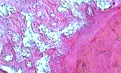 The Role of Stem Cells in Osteoreparation