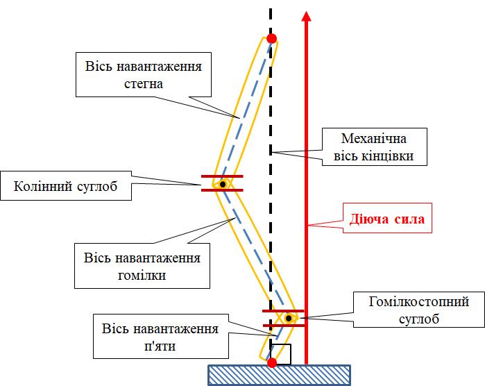 Deviation of the load axes from the mechanical axis of the limb