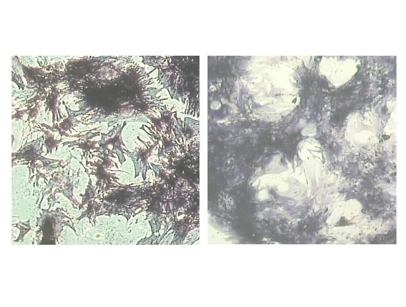 Morphofunctional Changes in Mesenchymal Stem Cells