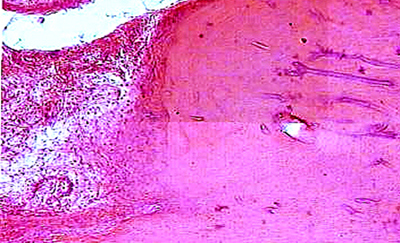 Disorders of Osteoreparation