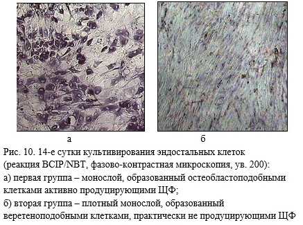Етапи виділення МСК кістковомозкового каналу для культивування