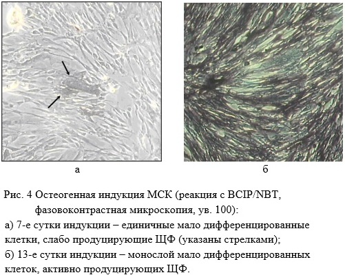 Microscopy of MSC monolayer formation and morphological transition during osteogenic induction.